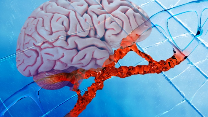 Gli scienziati scoprono che diversi disturbi mentali hanno molto in comune