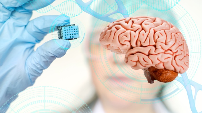 Un impianto cerebrale aiuta una persona paralizzata a comunicare con un computer